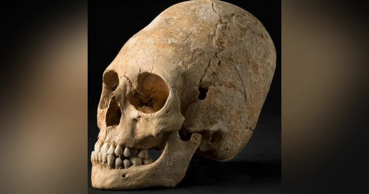 Elongated Skulls: Human or Alien
