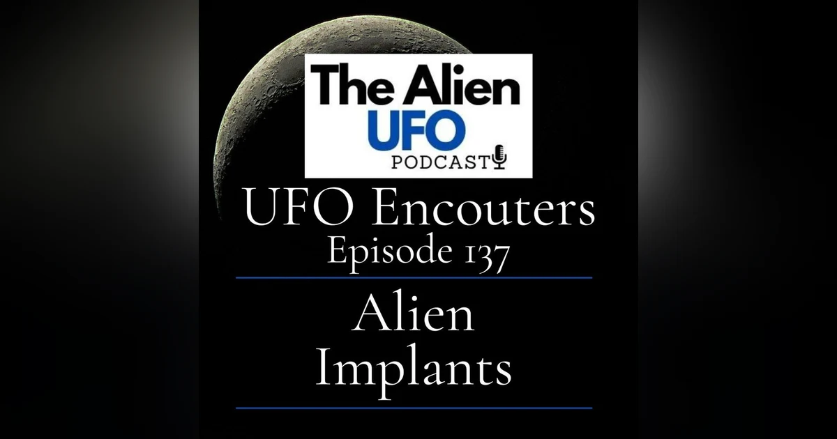 The Alien Implant Phenomenon