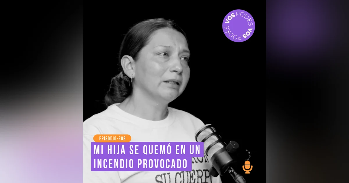 Mi hija se quemó en un incendio provocado: Invitada - Johana Maya