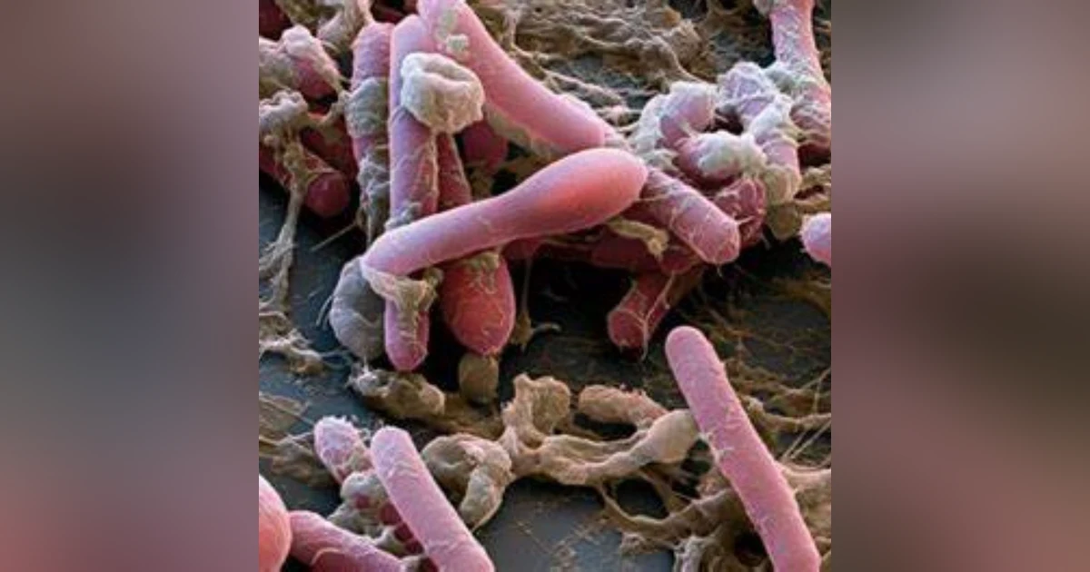 S5 E9: Paralysis on Purpose: The Story of Botulism