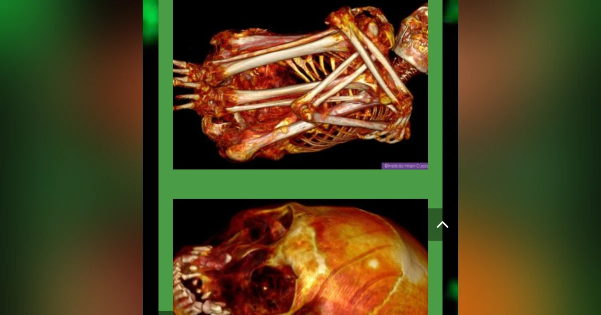 Peru Nazca Alien Mummies Confirmed Real in Mexico National Congress UFO Breifing
