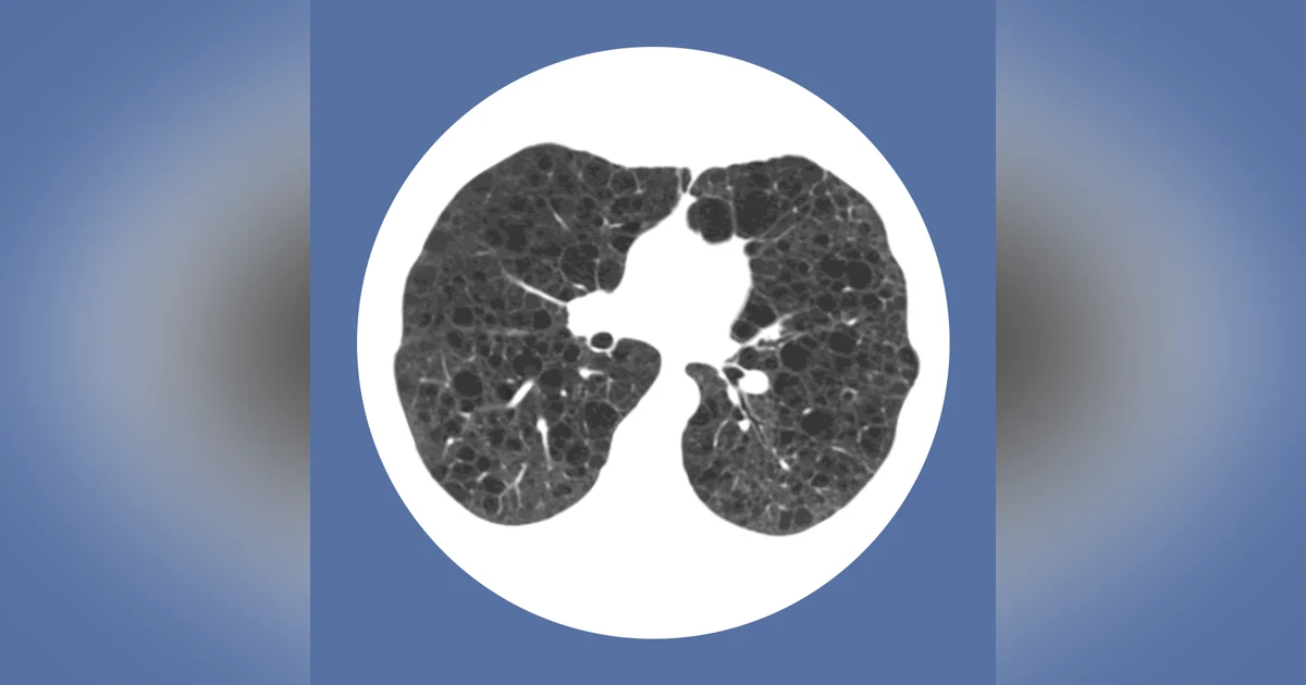 The Man Behind PulmCCM: Great Minds in Medicine
