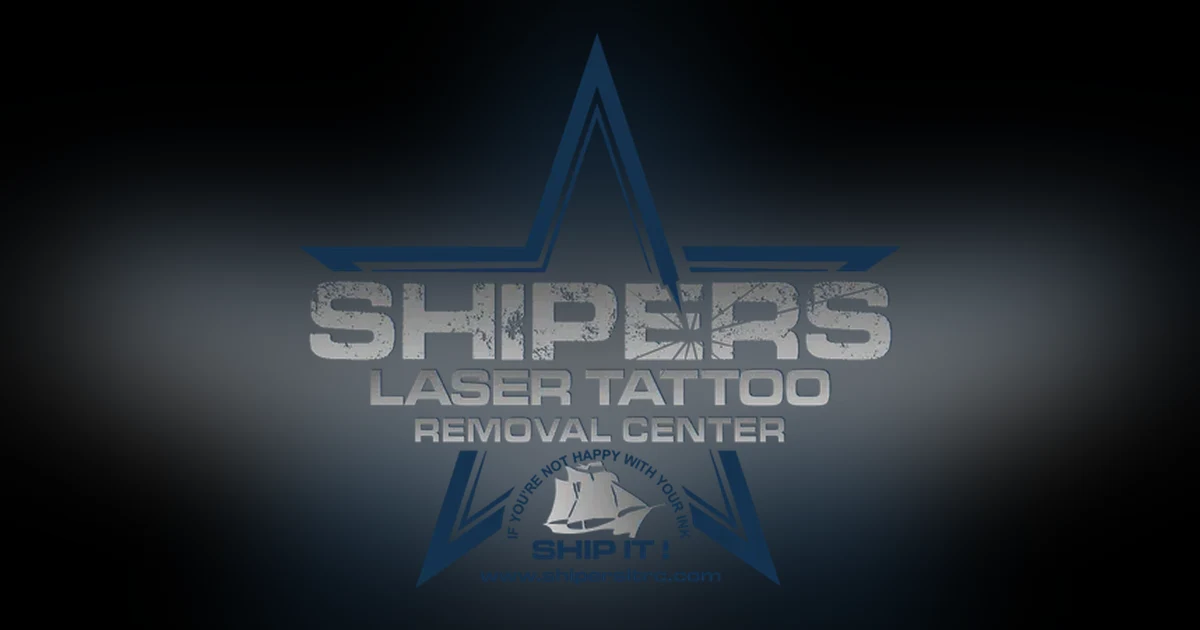 Tattoo Removal