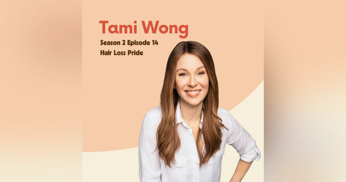 Tami Wong: Hair Loss Pride