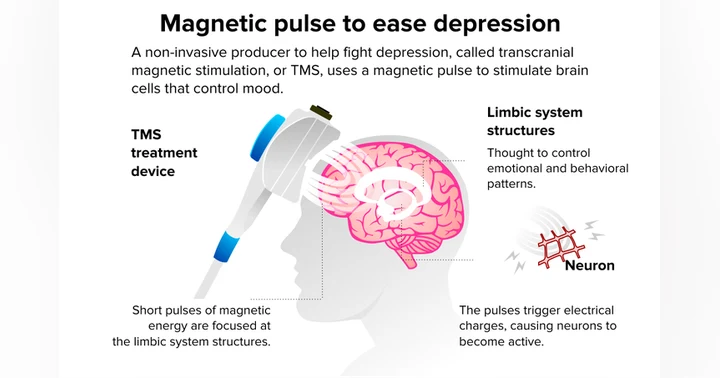 image for Transcranial Magnetic Stimulation: Could This Non-Medication Treatment Help You?