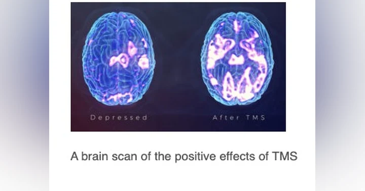 image for An Alternate Therapy For Depression