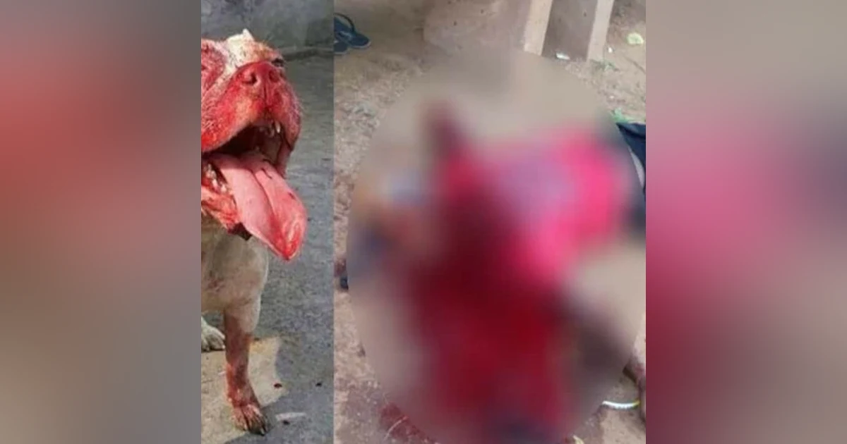 Dog Attacks in Texas: Real Danger in the Streets