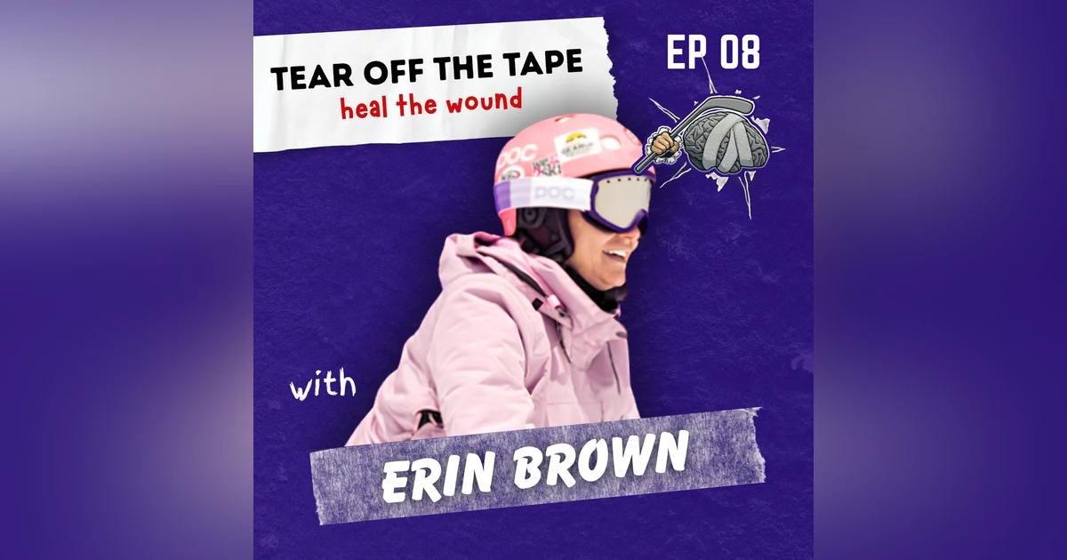 Broken Barbie: Erin’s Journey from Bullying to Amputation and Beyond