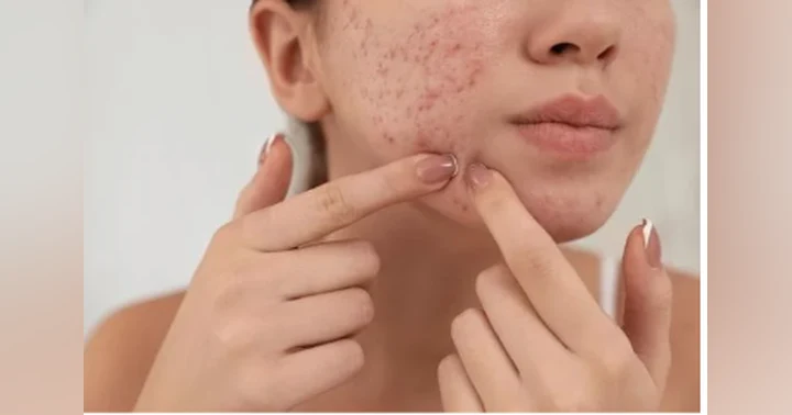image for Why Your Acne Routine Isn’t Working: 6 Mistakes Dermatologists and Estheticians See Every Day