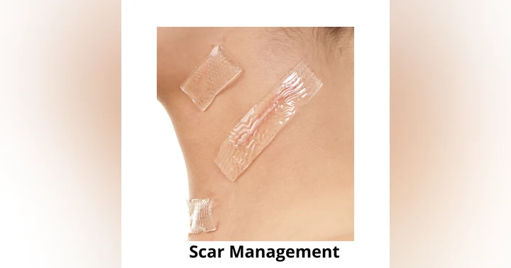 image for Scar Management and Healing: Evidence-Based Strategies from a Facial Plastic Surgeon
