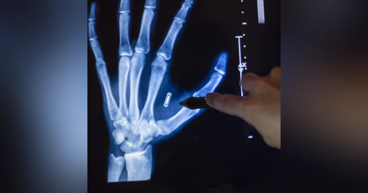 S9: The Invisible Crime: Illegal Microchip Implants and Microwave Technology - Replay