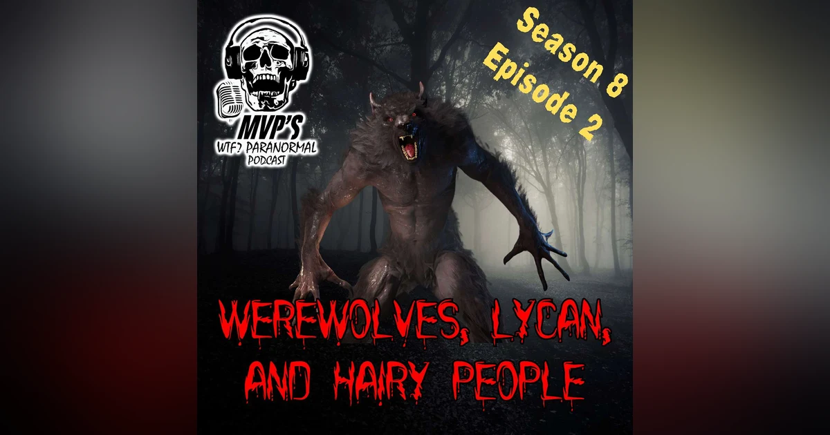 Werewolves, Lycan, and Hairy People S8 E2