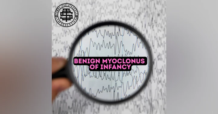 image for Benign Myoclonus Of Infancy