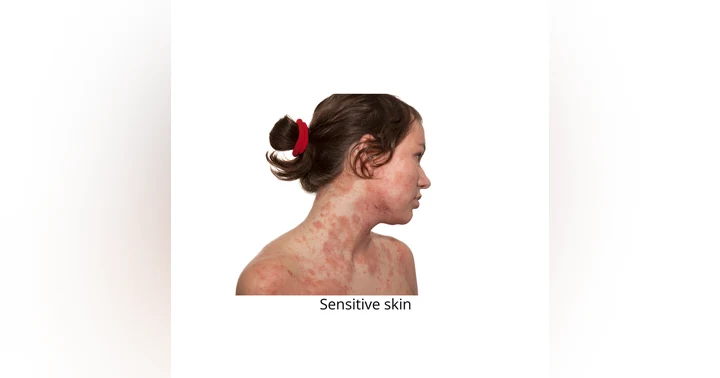 image for How to Care for Sensitive Skin, Eczema, and Psoriasis: A Clinical + Esthetic Guide