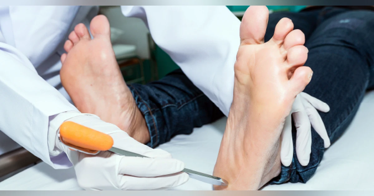 July 2021: Neurological Assessments