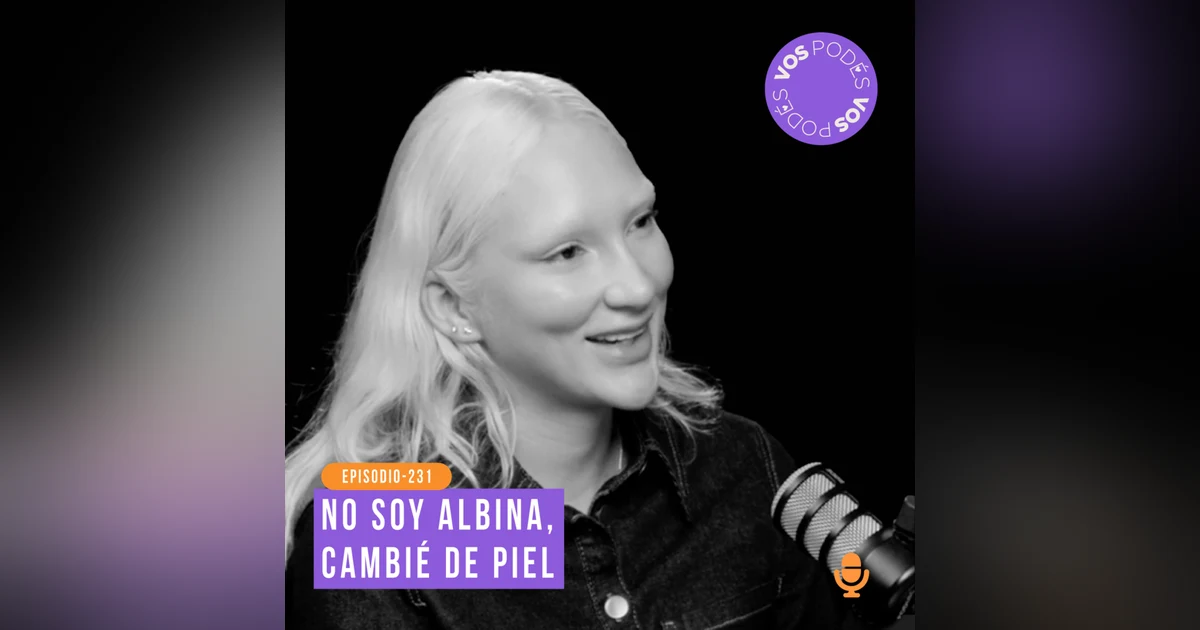 Un medicamento transformó su apariencia: Invitada - Mila Morales