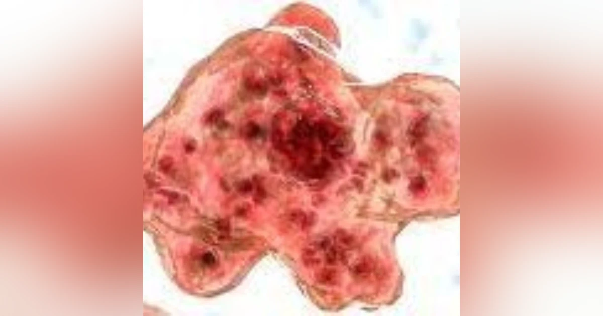 S8 E2: Brain Suckers: The Story of Naegleria fowleri