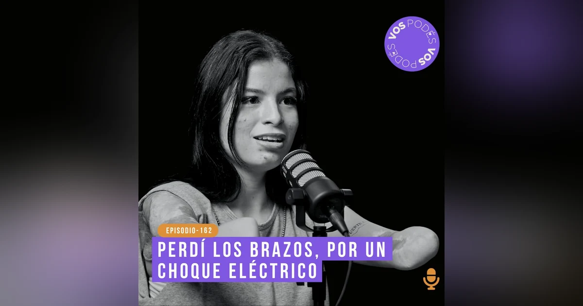 Perdí los brazos por un choque eléctrico - invitada: Karol Bastidas