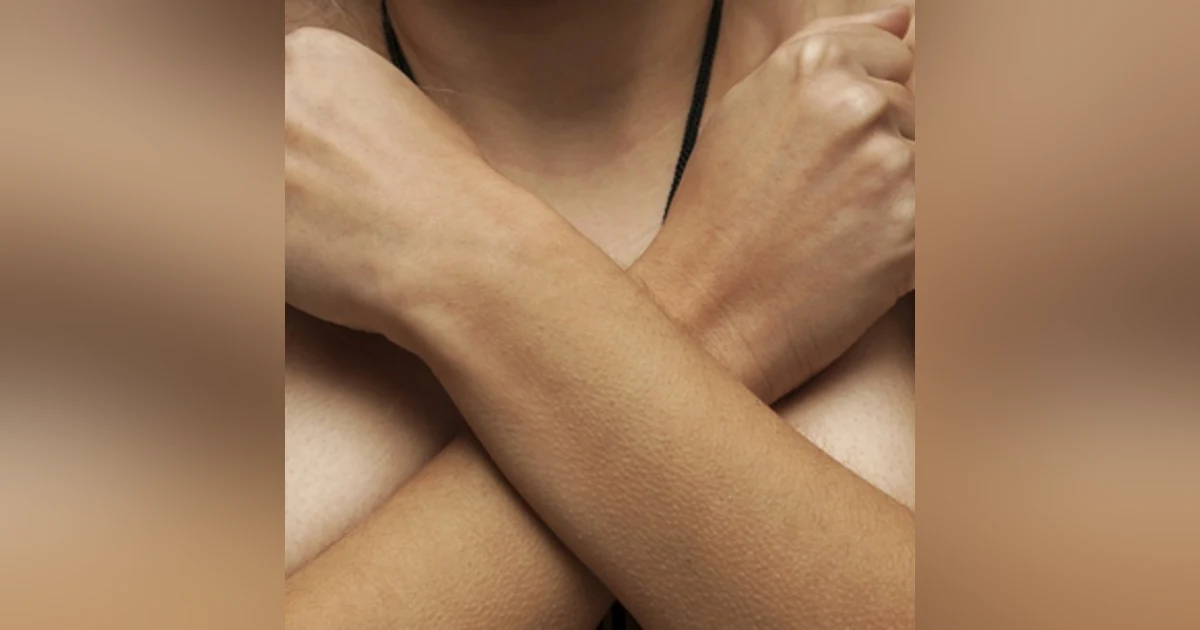 Depressed About Her Chest - Matthew Stapley June 28, 2021