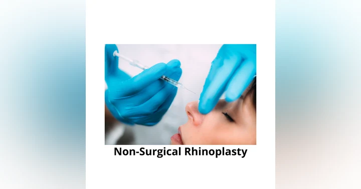 image for Non-Surgical Rhinoplasty Explained: Expert Insights on Liquid Nose Filler, Safety, and Results