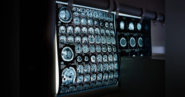 image for How AI Is Transforming Healthcare and Drug Discovery