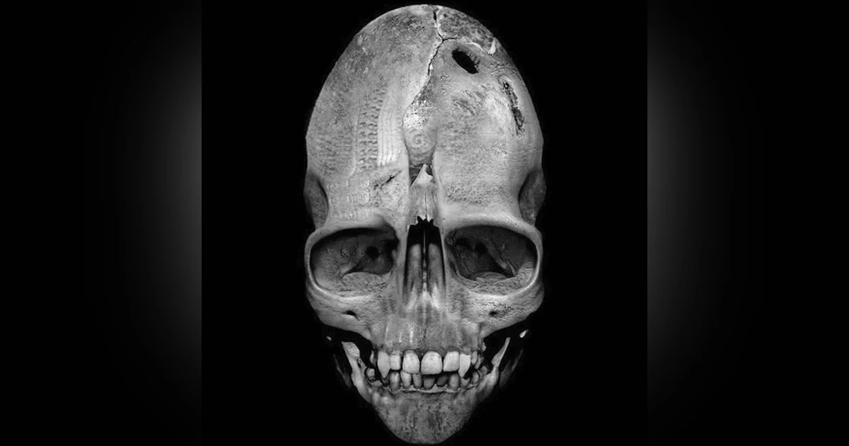 Skulls: Human or Alien