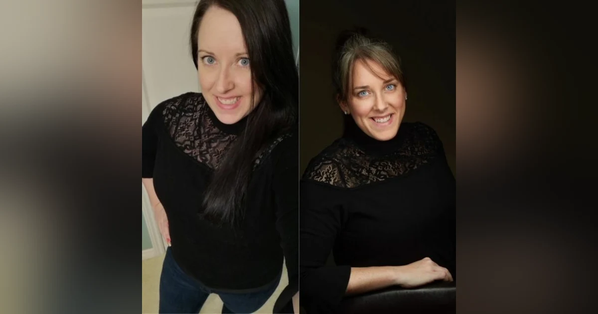Concussion, PCS and Identical Twins Ashley & Amy