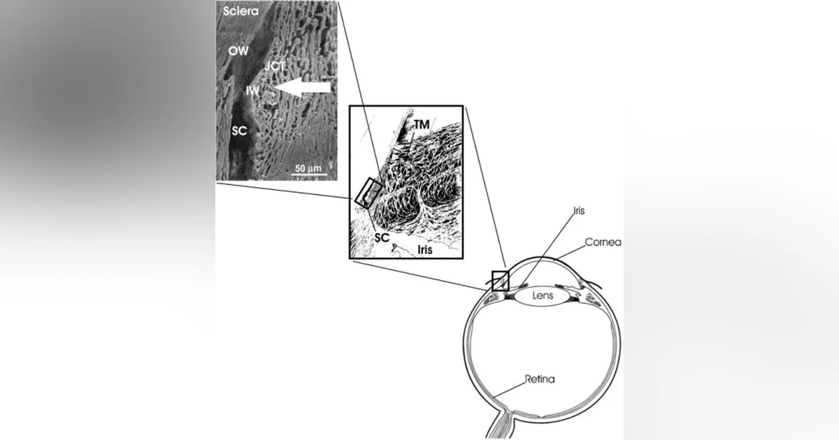 Ep 23 Talking About Glaucoma - 3Nov2014: ab-interno trabecular bypass surgery (mp3 version)